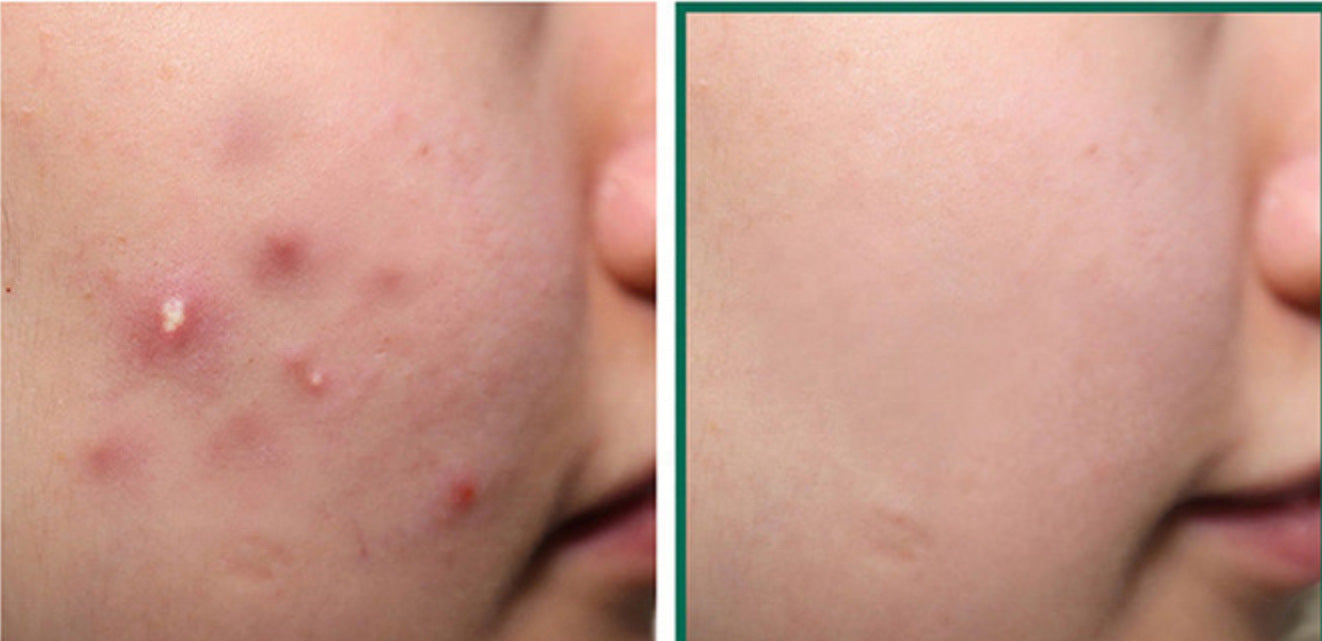 Cosmetic Facial Skin Care Licorice Root Fluoride Cosmetic Facial Skin Care Licorice Root Fluoride